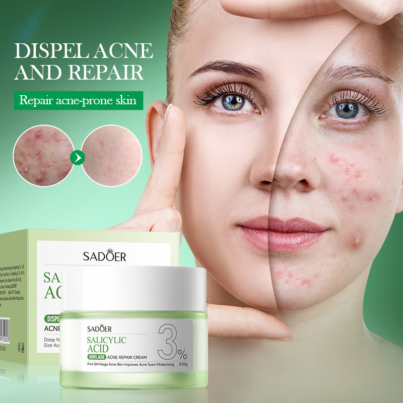 Salicylic Acid Blackhead Remover - Krim Perawatan Jerawat Asam Salisilat Memperbaiki