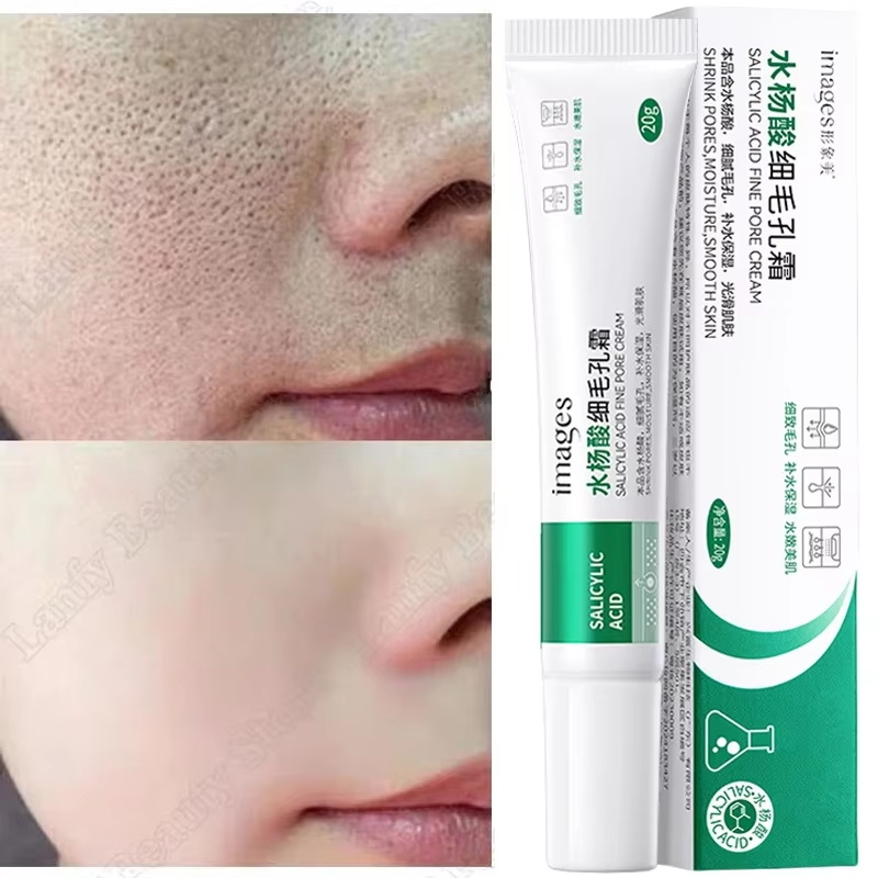 Salicylic Acid Blackhead Remover - Krim Pembersih Pori Asam Salisilat Mengecilkan