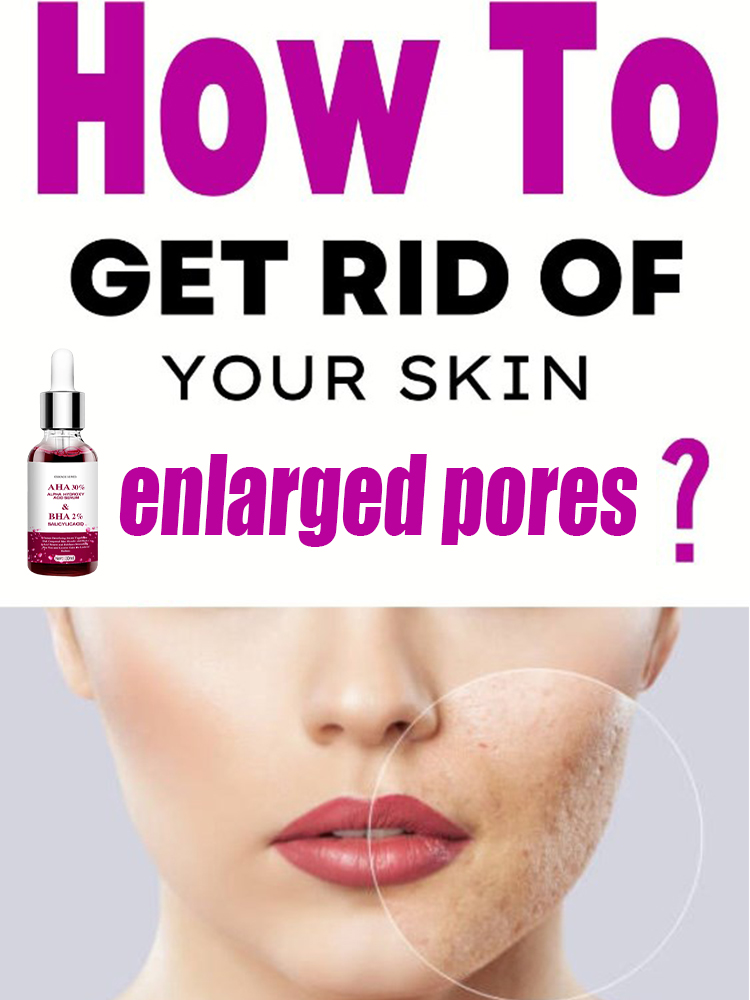 Serum Pengecil Pori-pori Asam  - Salicylic Acid Blackhead Remover ulasan dan harga