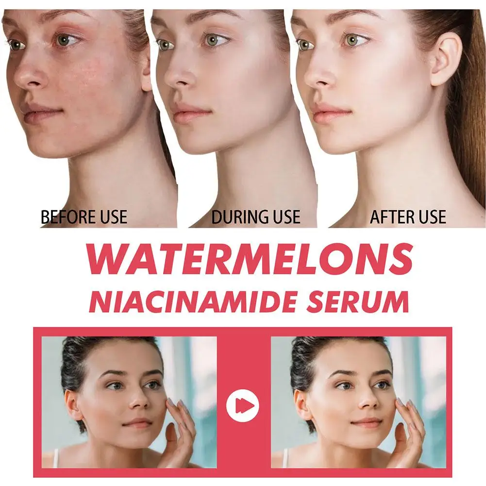 Serum Pelembab Niacinamide Cah - Hyaluronic Acid Facial Serum ulasan dan harga