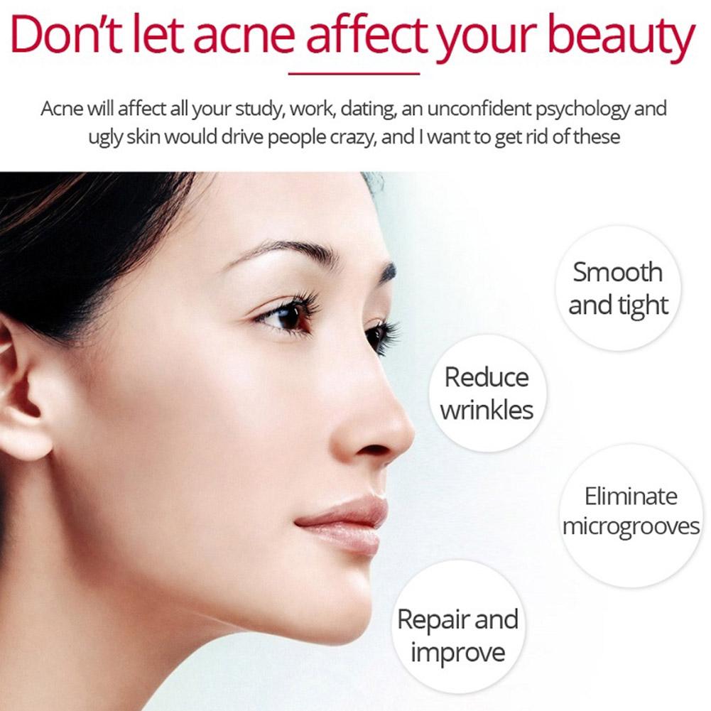 Retinol Krim Pengencang Pengan - Retinol Anti Wrinkle Cream ulasan dan harga