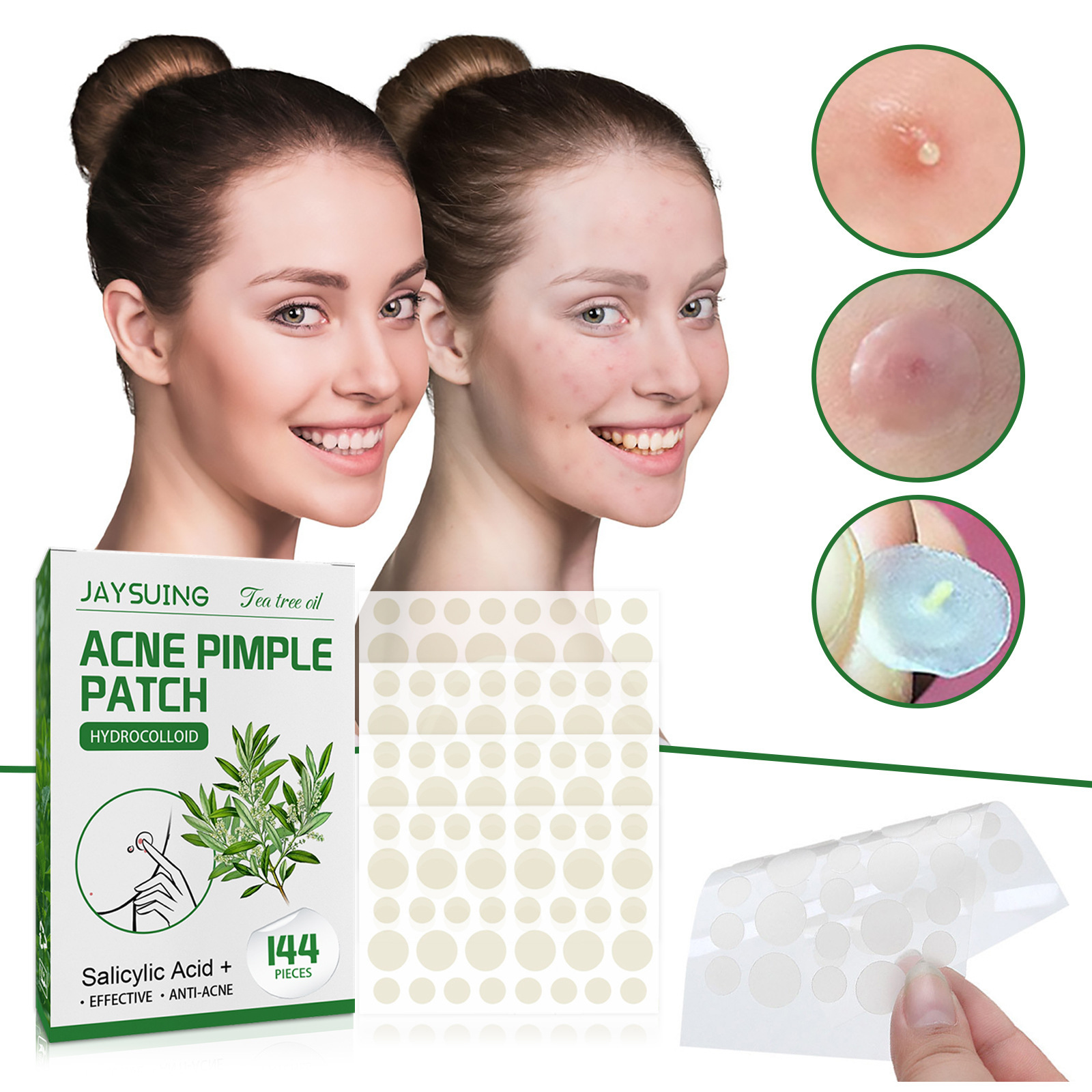 Patch Jerawat Hidrokoloid - Me - Hydrocolloid Pimple Patch ulasan dan harga