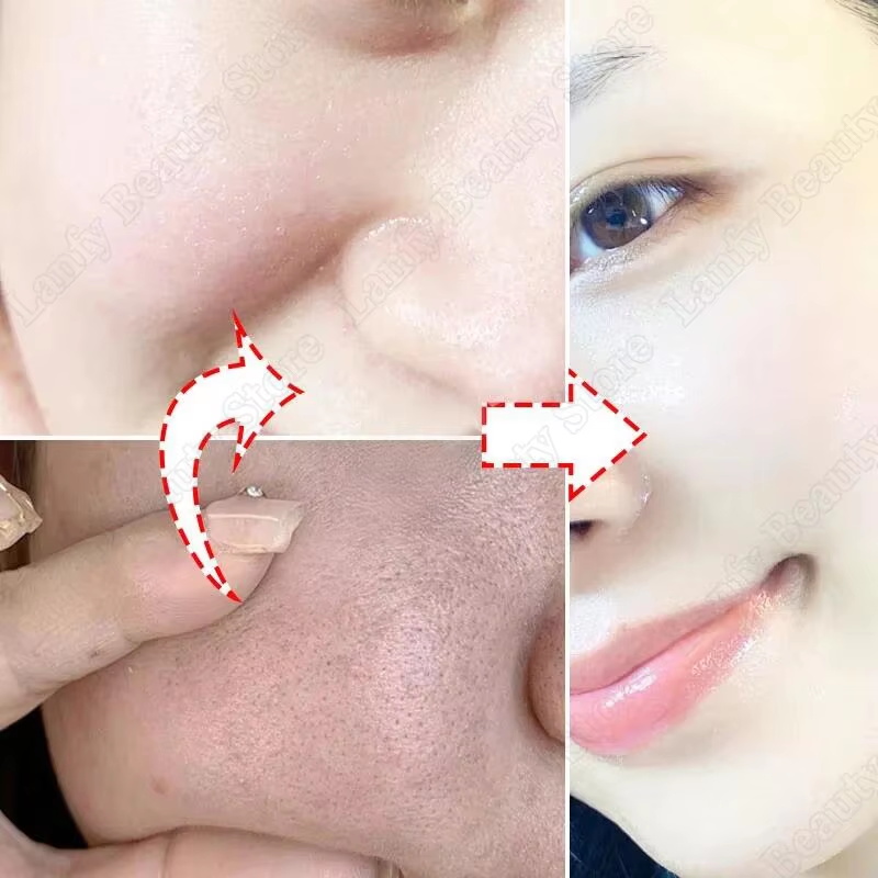 Krim Pembersih Pori Asam Salis - Salicylic Acid Blackhead Remover ulasan dan harga